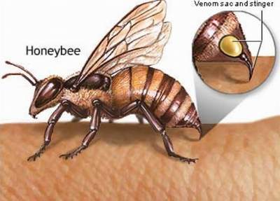 Cách sơ cứu khi bị ong đốt